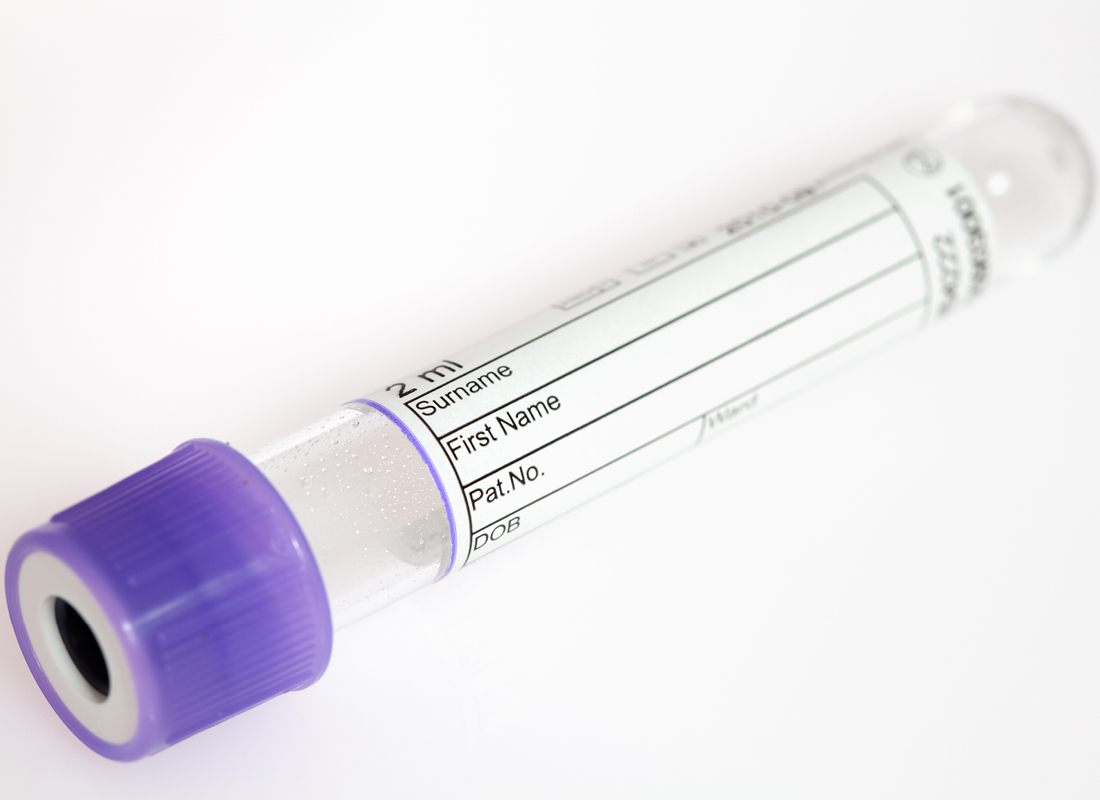 A test tube with a blank label and purple cap rests on a white surface.