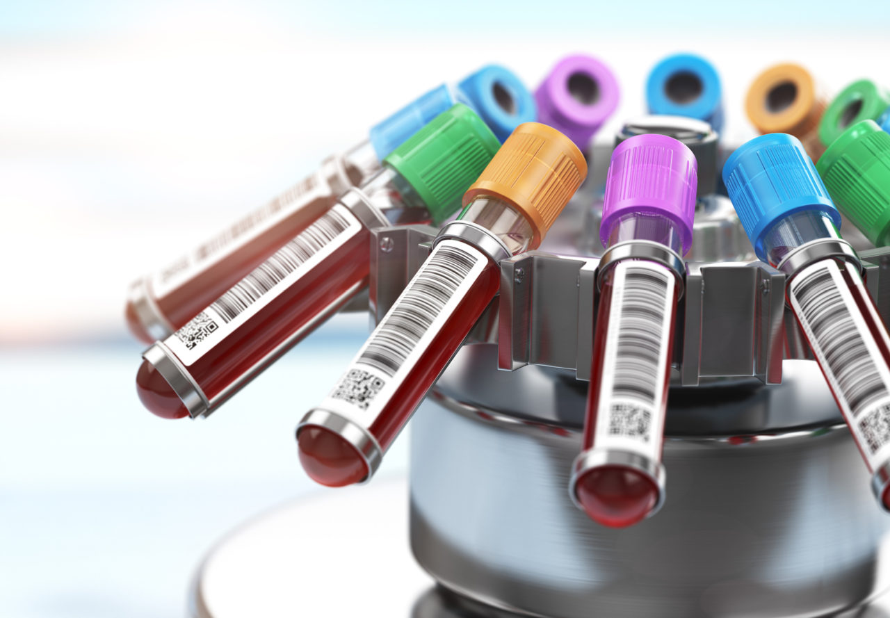 Eight New CLIAWaived Tests Your Lab Staff Need to Know About G2
