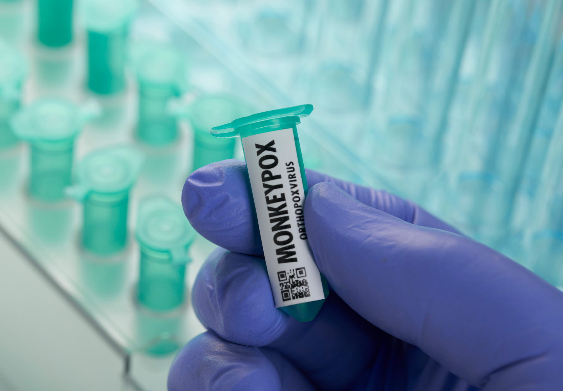 ACLA Low Reimbursement Jeopardizes Monkeypox Lab Testing Effort G2 