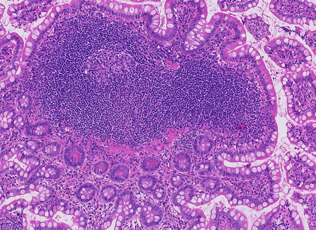 A whole-slide image showing the clarity and utility of digital pathology.