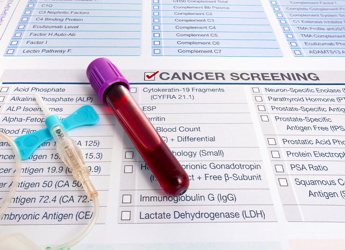 An IV tube and blood test tube sit on a test order form for cancer screening