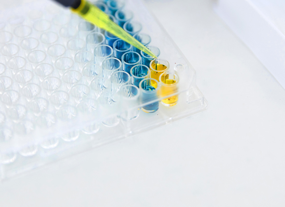 Closeup image of blue and yellow liquid being pipetted intro microwells, illustrating disease screening.